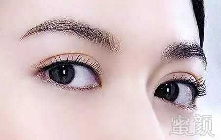https://img.miyanlife.com/mnt/timg/180826/11410151N-4.jpg