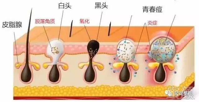 案例图片