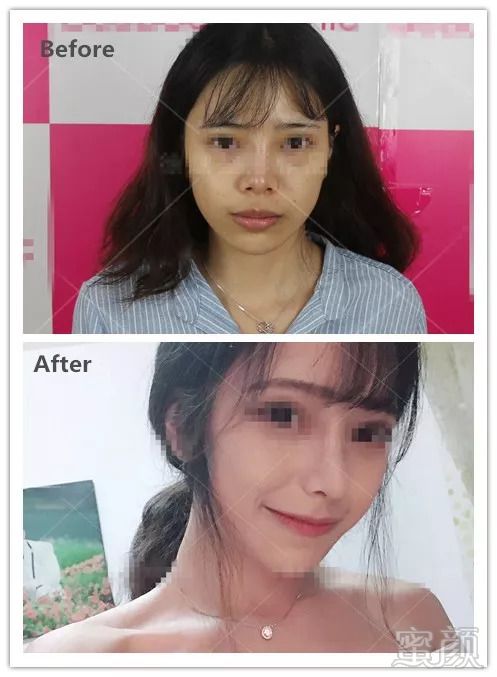 https://img.miyanlife.com/mnt/timg/180826/11441I125-1.jpg