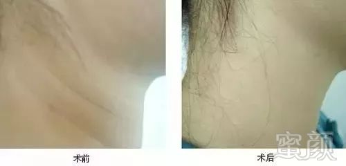 https://img.miyanlife.com/mnt/timg/180826/120421GX-15.jpg