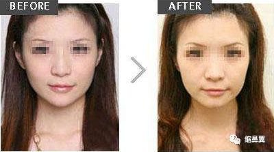 https://img.miyanlife.com/mnt/timg/180826/121HL533-3.jpg
