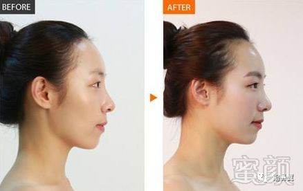 https://img.miyanlife.com/mnt/timg/180826/121HM042-2.jpg