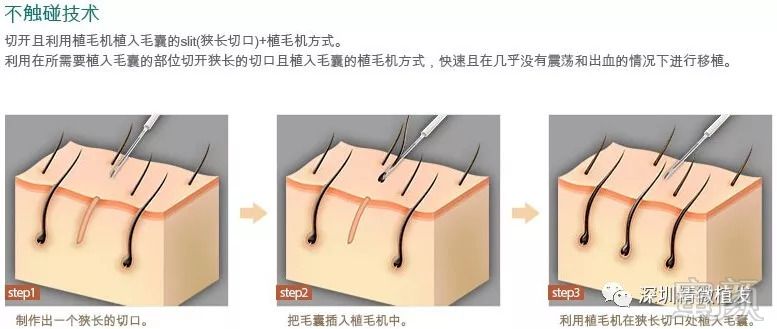 https://img.miyanlife.com/mnt/timg/180826/121P5M54-2.jpg