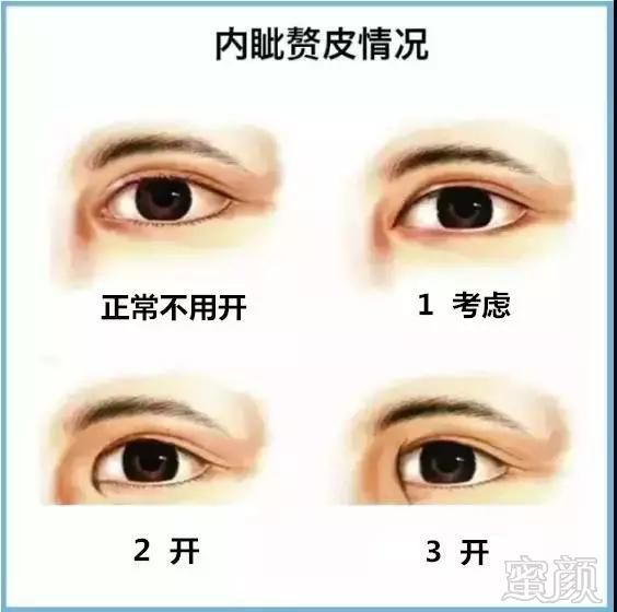 https://img.miyanlife.com/mnt/timg/180826/122244EJ-11.jpg