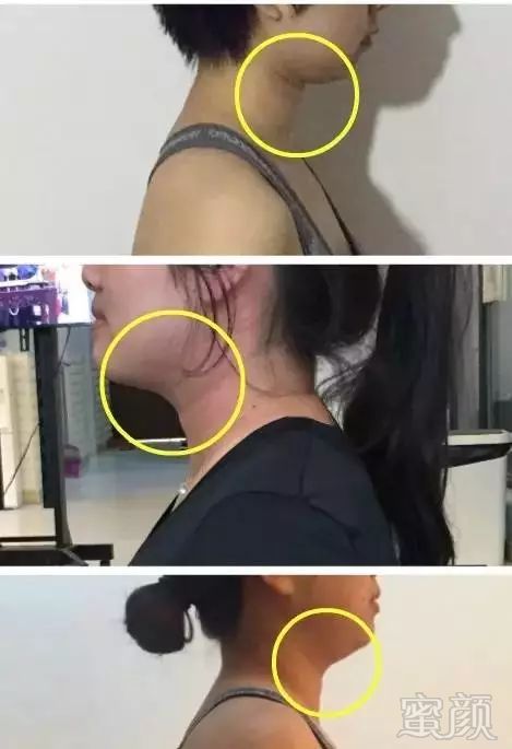 https://img.miyanlife.com/mnt/timg/180826/12230322R-4.jpg