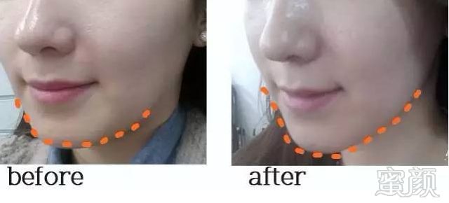 https://img.miyanlife.com/mnt/timg/180826/1223042455-11.jpg