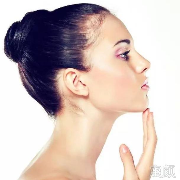https://img.miyanlife.com/mnt/timg/180826/12230432P-15.jpg