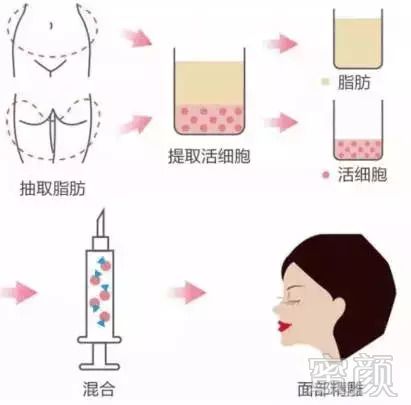 https://img.miyanlife.com/mnt/timg/180826/1223323032-2.jpg