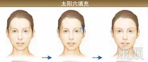 https://img.miyanlife.com/mnt/timg/180826/1223333Z6-4.jpg