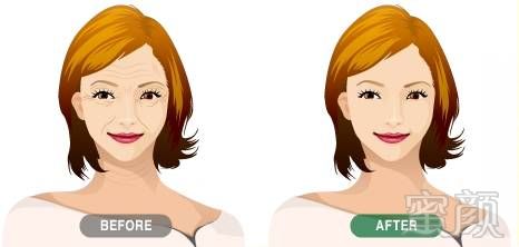 https://img.miyanlife.com/mnt/timg/180826/1223335I3-7.jpg