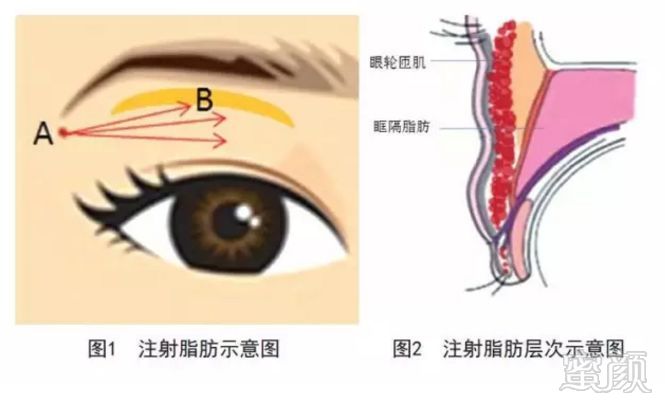 https://img.miyanlife.com/mnt/timg/180826/1224032037-1.jpg