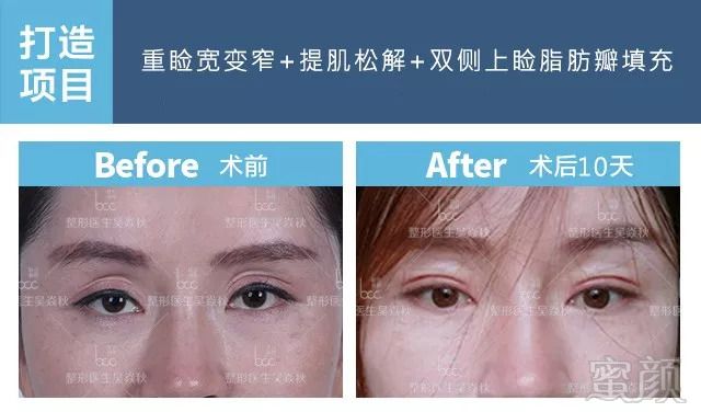 https://img.miyanlife.com/mnt/timg/180826/1224045G2-3.jpg