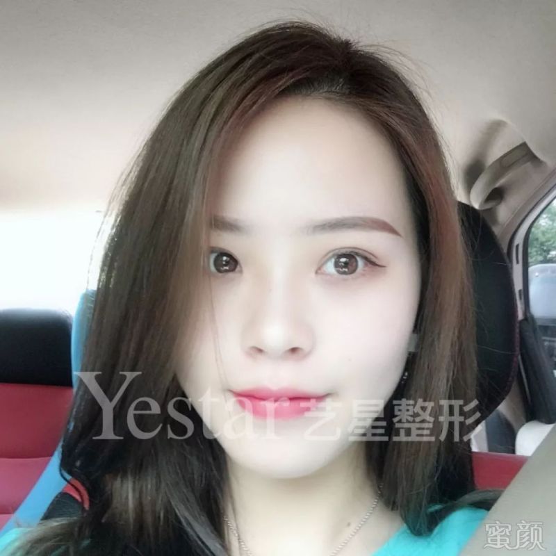 https://img.miyanlife.com/mnt/timg/180826/122T94443-10.jpg