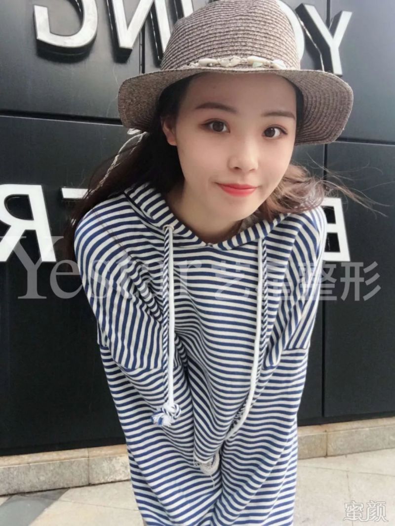 https://img.miyanlife.com/mnt/timg/180826/122TL029-7.jpg