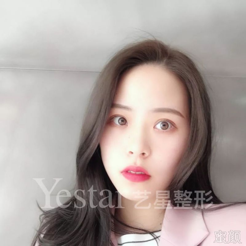 https://img.miyanlife.com/mnt/timg/180826/122Ta533-11.jpg