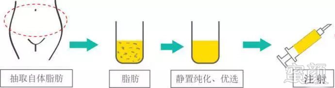 https://img.miyanlife.com/mnt/timg/180826/123052N29-1.jpg
