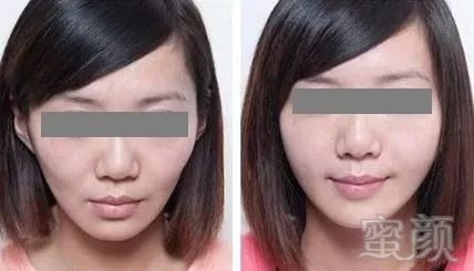 https://img.miyanlife.com/mnt/timg/180826/1230533418-3.jpg