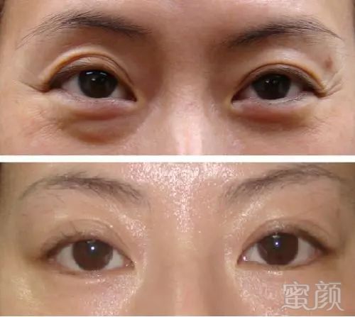 https://img.miyanlife.com/mnt/timg/180826/1232193258-2.jpg