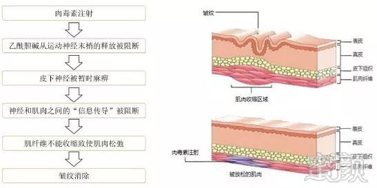 https://img.miyanlife.com/mnt/timg/180826/12321Q305-1.jpg