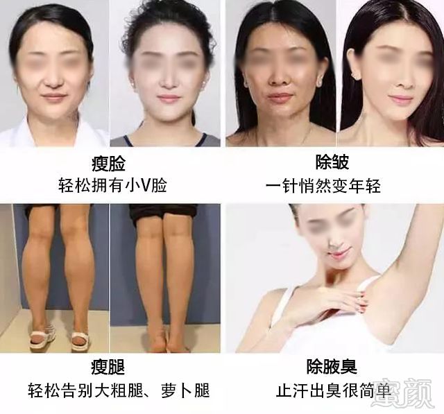 https://img.miyanlife.com/mnt/timg/180826/1232205S0-3.jpg