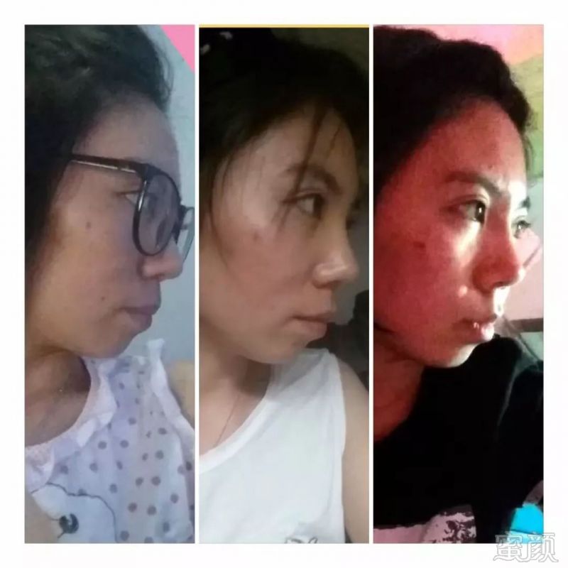 https://img.miyanlife.com/mnt/timg/180826/12441L440-1.jpg