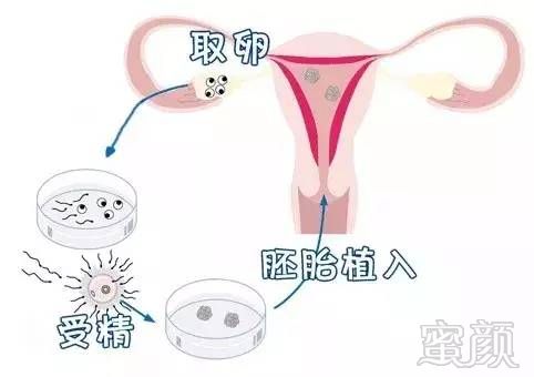 https://img.miyanlife.com/mnt/timg/180826/1245061208-0.jpg