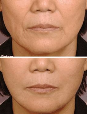 https://img.miyanlife.com/mnt/timg/180826/124A31225-1.jpg