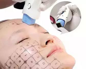 https://img.miyanlife.com/mnt/timg/180826/124J115H-6.jpg