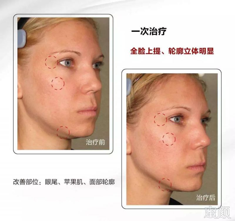 https://img.miyanlife.com/mnt/timg/180826/124KaD2-1.jpg