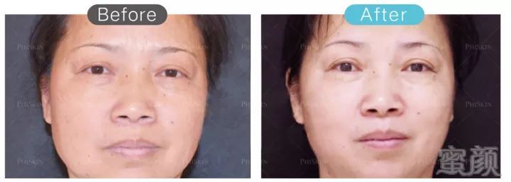 https://img.miyanlife.com/mnt/timg/180826/124P52B5-3.jpg