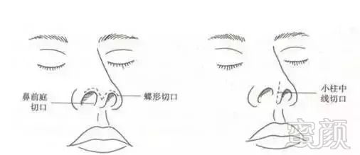 https://img.miyanlife.com/mnt/timg/180826/1259563V0-12.jpg