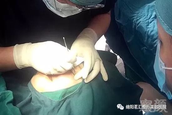 https://img.miyanlife.com/mnt/timg/180826/13000M2B-11.jpg