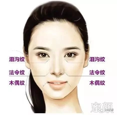 https://img.miyanlife.com/mnt/timg/180826/1305301332-1.jpg