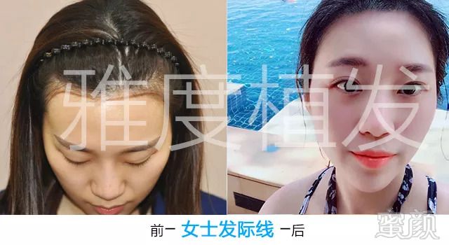 https://img.miyanlife.com/mnt/timg/180827/1125042193-9.jpg