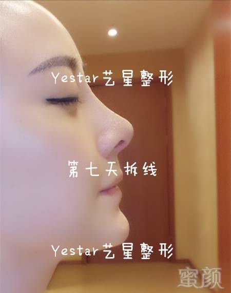 https://img.miyanlife.com/mnt/timg/180827/11260B214-8.jpg