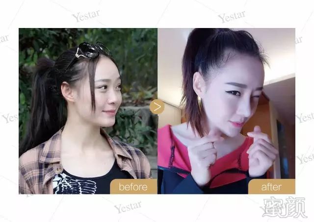 https://img.miyanlife.com/mnt/timg/180827/11260MY2-12.jpg