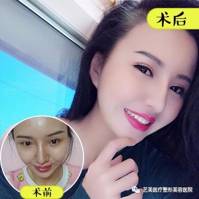 https://img.miyanlife.com/mnt/timg/180827/11452BY7-3.jpg