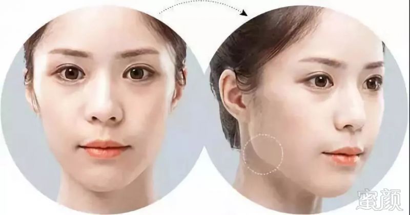 https://img.miyanlife.com/mnt/timg/180827/11491B606-2.jpg