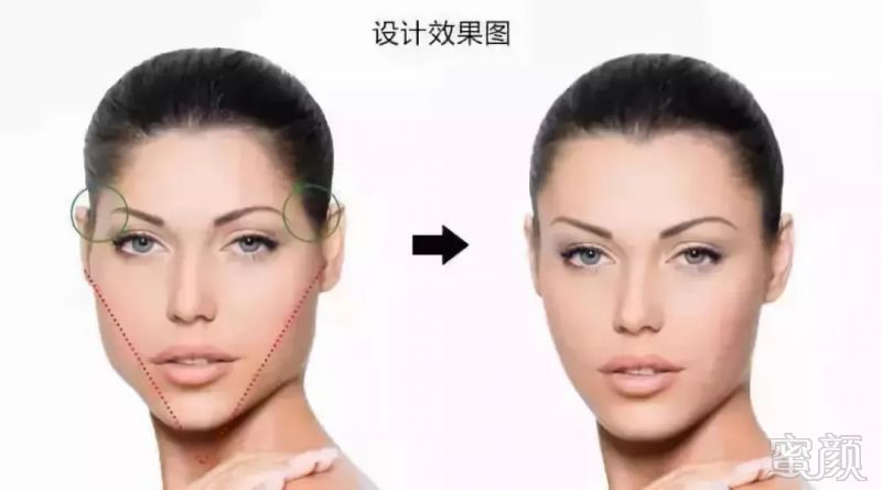 https://img.miyanlife.com/mnt/timg/180827/11491H227-5.jpg