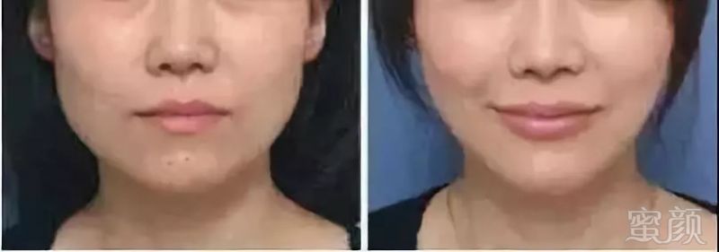 https://img.miyanlife.com/mnt/timg/180827/11491KS0-4.jpg