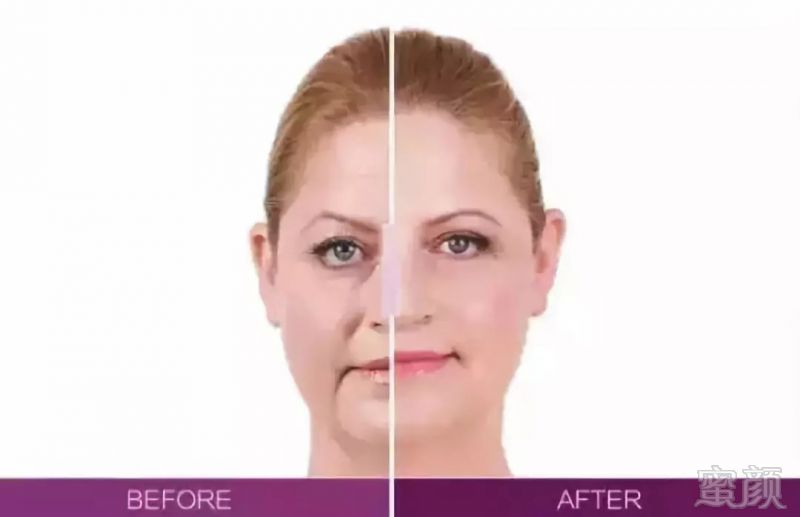 https://img.miyanlife.com/mnt/timg/180827/120A22N1-9.jpg