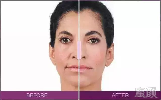 https://img.miyanlife.com/mnt/timg/180827/120A33602-10.jpg
