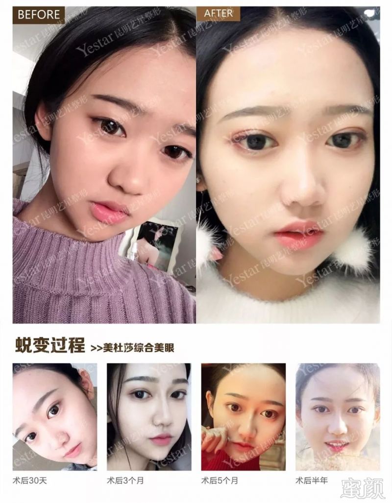https://img.miyanlife.com/mnt/timg/180827/12320J403-9.jpg