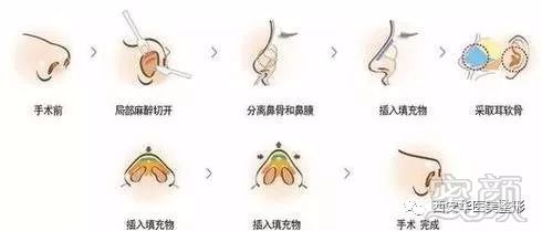 https://img.miyanlife.com/mnt/timg/180827/1233591C3-3.jpg