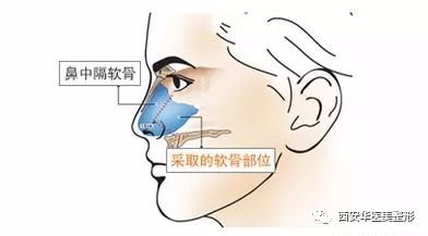 https://img.miyanlife.com/mnt/timg/180827/12335961D-5.jpg