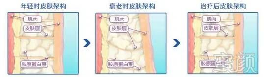 https://img.miyanlife.com/mnt/timg/180827/12341142Z-6.jpg