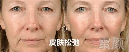 https://img.miyanlife.com/mnt/timg/180827/1234115351-7.jpg