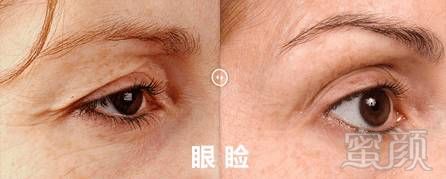 https://img.miyanlife.com/mnt/timg/180827/123411N54-8.jpg