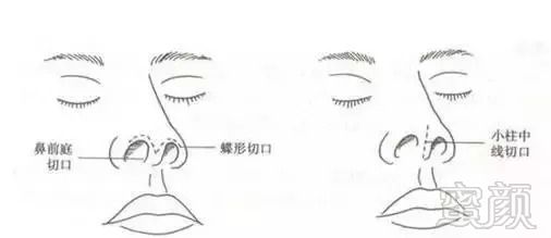 https://img.miyanlife.com/mnt/timg/180827/12350622F-1.jpg