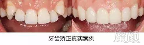 https://img.miyanlife.com/mnt/timg/180827/123P22964-6.jpg